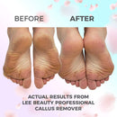 Lee Beauty Professional Callus Remover Extra Strength Gel for Feet, at Home Pedicure Results, 8 Oz LeeBeauty Professional