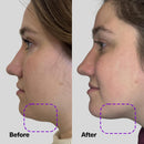 SickScience ShapeShift Advanced Jaw & Neck Firming Serum - Double Chin Reducer, Face Tightening Treatment with Exosome Technology to Lift Sagging Skin & Wrinkles in both Women & Men, 1.7oz Infinity Warehouse