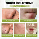 Blackhead Peel Off Face Mask, SHVYOG 3-in-1 Blackhead Remover Mask with Brush & Tea Tree Serum, Charcoal Face Mask for Deep Cleansing Blackheads, Dirts, Pores, Oil(100g+30ml) SHVYOG