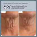 Alpha-H Retinol Reboot Body Treatment - Firm & Smooth Skin (120ml) | Softens Fine Lines, Redness & Uneven Tone, For Neck, Décolletage, Arms & Legs, Retinol-Powered, Cruelty Free, Australian Made Infinity Warehouse