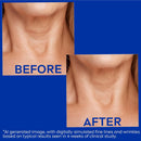 NIVEA Skin Firming and Anti Wrinkle Neck and Chest Cream with Q10, Creatine and Provitamin B5, Skin Firming Body Cream Reduces the Look of Fine Lines and Wrinkles, 6.7 Oz Tube - Infinity Warehouse