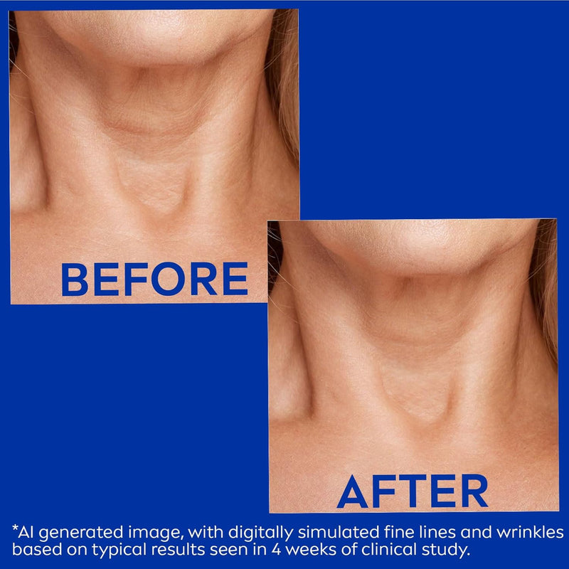 NIVEA Skin Firming and Anti Wrinkle Neck and Chest Cream with Q10, Creatine and Provitamin B5, Skin Firming Body Cream Reduces the Look of Fine Lines and Wrinkles, 6.7 Oz Tube - Infinity Warehouse