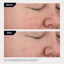 Revision Skincare Retinol Complete® 0.5 Anti Aging Serum, Reduces Fine Lines and Wrinkles, Hydrating and Smoothing Infinity Warehouse