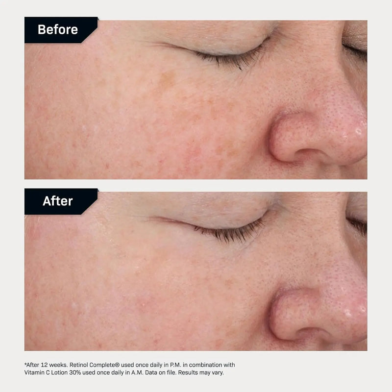 Revision Skincare Retinol Complete® 0.5 Anti Aging Serum, Reduces Fine Lines and Wrinkles, Hydrating and Smoothing Infinity Warehouse