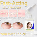 Milia Remover Treatment Serum 40ml,Milia Removal for Eyes & Face,Milia Acne Serum,Fat Granule Clearing Skin Essence Infinity Warehouse