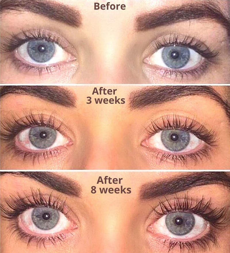 Show Lash Eyelash Growth Serum for Longer, Thicker, Gorgeous Looking Lashes. Irritation Free Eyelash Serum LeVaye'