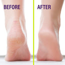 Heel-Seal - The