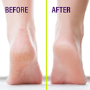 Heel-Seal - The