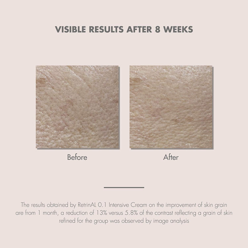Eau Thermale Avene - RetrinAL 0.1 Intensive Cream - Retinaldehyde - Rejuvenates Skin & Helps Reduce Signs of Aging - Airless Pump - 1.0 fl.oz. Eau Thermale Avène