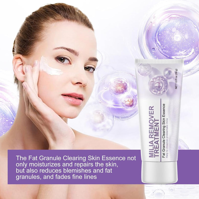 Milia Remover Cream for Eyes and Face,Milia Spot Remover with Salicylic Acid ,Milia Acne Cream (1 Fl Oz (Pack of 1)) Infinity Warehouse