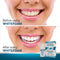 EverSmile WhiteFoam Retainer Cleaner, Invisible Aligner Cleaner, Dental Cleaner for Retainer, Aligners & Trays, Kills Bacteria, Whitens Teeth & Eliminates Bad Breath - Travel Size (2 Pack - 25 ml) EverSmile