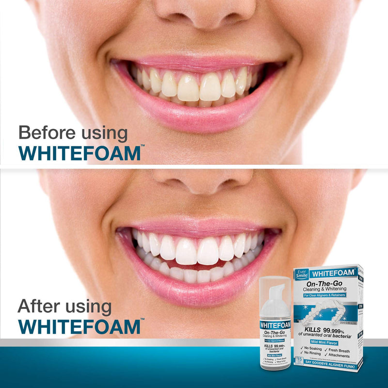 EverSmile WhiteFoam Retainer Cleaner, Invisible Aligner Cleaner, Dental Cleaner for Retainer, Aligners & Trays, Kills Bacteria, Whitens Teeth & Eliminates Bad Breath - Travel Size (2 Pack - 25 ml) EverSmile