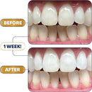 Lumineux Ultimate Whitening Kit Bundle - Contains Toothpaste, Mouthwash, Strips and Whitening Pen - Enamel Safe and Clinically Proven to Whiten Without The Sensitivity - Removes Coffee and Tea Stains Infinity Warehouse