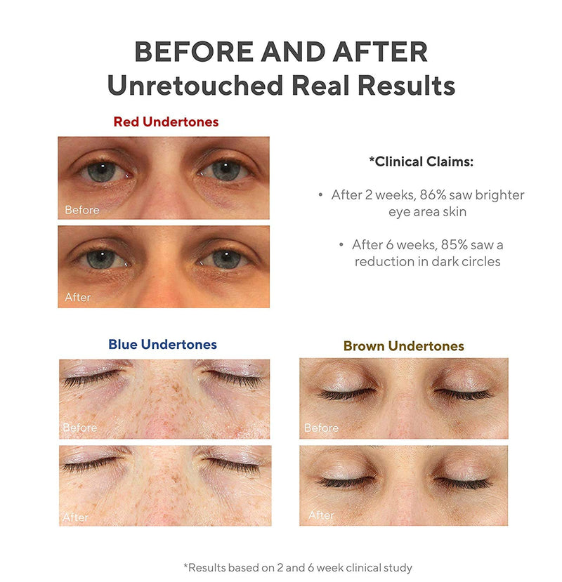 Murad Environmental Shield Vita-C Eyes Dark Circle Corrector - Dark Circle Eye Treatment - Gold Stabilized Vitamin C Skin Care Eye Serum - Anti-Aging Under Eye Cream for Dark Circles, 0.5 Fl Oz Murad