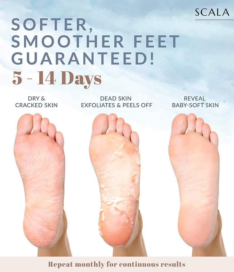 Foot Peel Exfoliating Mask (2 pack) - Deep Skin Exfoliation for Dry Cracked Feet, Calluses, and Rough Heels for Men & Women. Get Baby-Soft and Smooth Feet with Scala Foot Peel Mask Scala