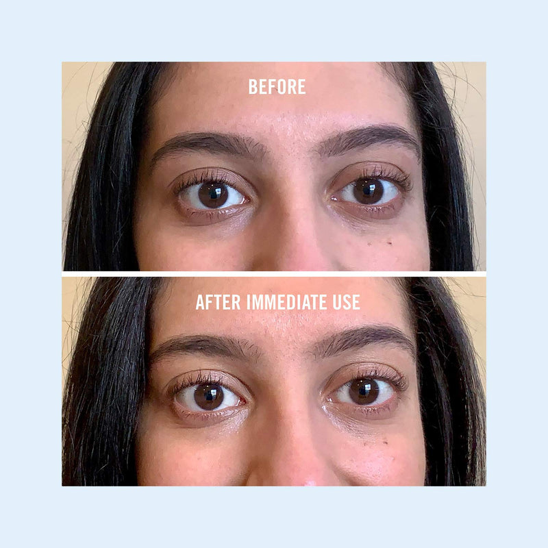 First Aid Beauty Eye Duty Niacinamide Brightening Cream, Illuminating Eye Cream for Dark Circles and Puffiness, 0.5 oz. First Aid Beauty