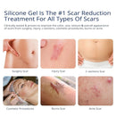 100% Silicone Scar Gel 2 Pack: 2 x 1.06oz Tubes for Surgical Scars, C-Section, Acne, Keloids, Burns, Stretch Marks – Advanced Scar Treatment for Old & New Scars Infinity Warehouse
