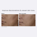 PCA SKIN Intensive Brightening Treatment - 0.5% Pure Vitamin A Retinol Face Serum for Discoloration & Dark Spots (1 oz) PCA SKIN