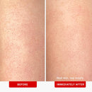 First Aid Beauty - KP Bump Eraser Body Scrub with 10% AHA, Keratosis Pilaris Skin Exfoliater with Glycolic and Lactic acids, Helps Reduce Chicken Skin Bumps, Safe for Sensitive Skin, 8 oz, 2ct Infinity Warehouse
