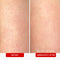 First Aid Beauty - KP Bump Eraser Body Scrub with 10% AHA, Keratosis Pilaris Skin Exfoliater with Glycolic and Lactic acids, Helps Reduce Chicken Skin Bumps, Safe for Sensitive Skin, 10 oz Infinity Warehouse