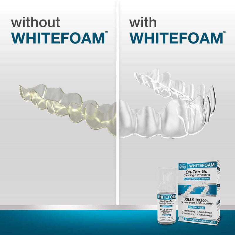 EverSmile WhiteFoam Retainer Cleaner, Invisible Aligner Cleaner, Dental Cleaner for Retainer, Aligners & Trays, Kills Bacteria, Whitens Teeth & Eliminates Bad Breath - Travel Size (2 Pack - 25 ml) EverSmile