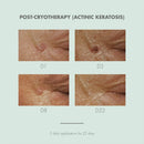 Eau Thermale Avène Cicalfate+ Restorative Protective Cream, Wound Care, Reduce Appearance of Scars Beauty Coquette