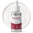 Rosacea Treatment for Face Anti-Redness Serum 30 mL / 1.01 fl oz Infinity Warehouse
