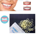 IVORIE Dental Orthodontic Rubber Bands Elastics Braces Teeth Gap 100pcs (3/16" Rabbit 4.5oz (High)) IVORIE
