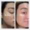 Geologie Complete Skincare Set for Men & Women | 3-Month Simple & Effective Daily Clear Skin Routine | Acne, Oily Skin, Dark Spots | Face Wash 2-Pack, Retinol Face Cream, SPF15 Moisturizer & Eye Cream Infinity Warehouse