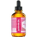 Rosehip Seed Oil by Leven Rose, 100% Pure Unrefined Cold Pressed Anti Aging Rose Hip Moisturizer for Hair Skin & Nails, 1 Fl. Oz… Leven Rose