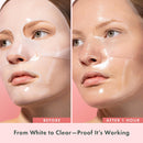 Rael Hydrogel Masks, Deep Hydration Skincare (Collagen PDRN, 4 Ct) | Peptides & Hyaluronic Acid, Moisturizing, Advanced PM Routine for Glowing Skin, Daily Korean Skin Care Infinity Warehouse