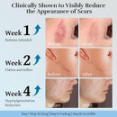 Advanced Scar Cream, Scar Reduction Treatment for Improves Skin Texture & Helps Remove Acne, Surgery, C Section, Burn, Keloid & Hypertrophic Scars 1.76 Oz (50g) Infinity Warehouse