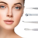Blackhead, Whitehead, Pimple, Zit Remover Kit, Comedone Extractor Tool Treatment Skin Blemish and Acne Scar Removal 4-piece Alayna (TM)