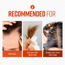 CRAZY SKIN Beers Shampoo - BIOTIN shampoo for hair loss, Rich with Beer Yeast for Hair Regrowth and Thickening, thinning hair, Sulfate free,10.15 fl oz(300g) X 2 Bottles CRAZY SKIN