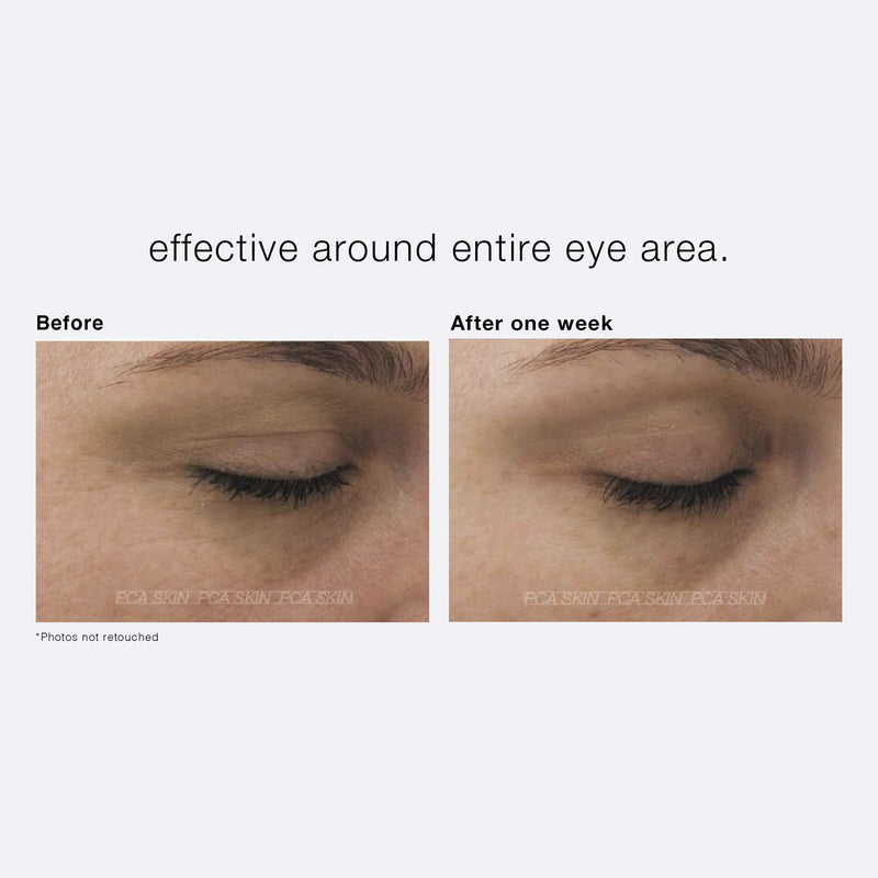 PCA SKIN Ideal Complex Restorative Eye Cream - Anti-Aging Brightening Eye Treatment for Dark Circles, Puffiness, Fine Lines & Wrinkles (0.5 oz) PCA SKIN