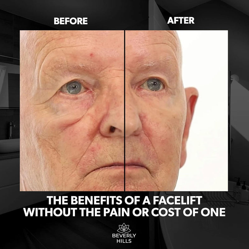 Beverly Hills Mens Instant Facelift and Eye Serum Treatment for Dark Circles, Puffy Eyes, and Wrinkles Infinity Warehouse