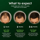 AlphaInfuse™ Scalp Nourishing Serum for Men – Ginseng & Eclipta Botanical Blend for Fuller-Looking, Thicker-Looking Hair and Healthy Scalp – 32ml – 2 Month Supply Infinity Warehouse