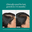 Nutrafol Women's Hair Growth Supplements, For Women 18-44 Years Old, Clinically Tested for Visibly Thicker, Stronger Hair, 100% Vegan Ingredients, Dermatologist Recommended - 1 Month Supply Infinity Warehouse