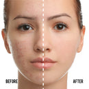 Catkin Phoenix Cushion Foundation Buildable Coverage Anti-Aging Serum Makeup, Sheer Satin Finish, Refill Included, Light Beige 0.46 Oz x 2, C01 NATURAL Infinity Warehouse