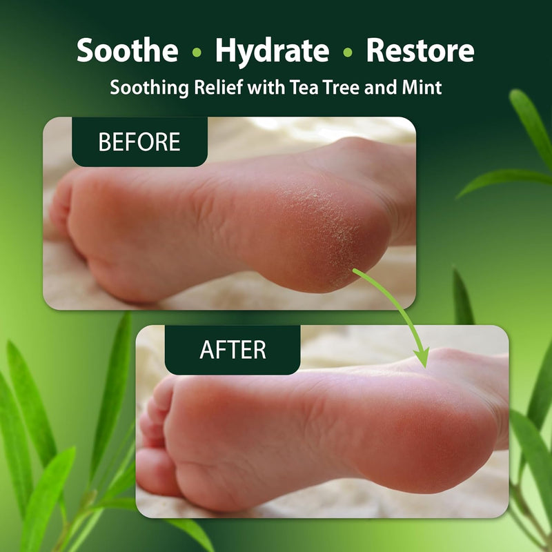 Foot and Body Oil with Tea Tree Oil - Hydrating Foot Care and Foot Spa for Cracked Heel Repair - Soothes Dry, Irritated Skin and Foot Odor - (4oz) Infinity Warehouse