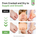 SAVILAND Antifungal Cream FSA-HSA Max Strength: 25% Undecylenic Acid Anti Fungal Cream for Skin Athletes Foot Jock Itch Ringworm Foot Fungus Treatment Comfort with Tea Tree & Oregano Oil 4.23 oz Infinity Warehouse
