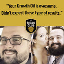 The Beard Club Advanced Beard Growth Kit - Derma Roller, Beard Growth Oil, Beard Growth Vitamins and Growth Vitamin Spray, Beard Shampoo and Beard Brush The Beard Club