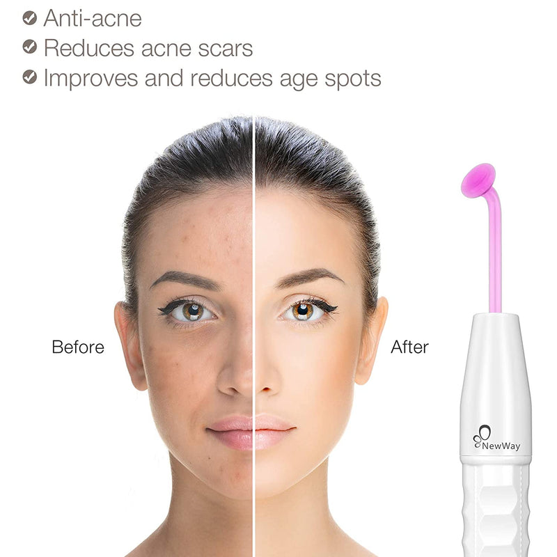 NewWay High Frequency Facial Therapy Wand Machine with 4 Argon Tube for Skin Tightening, Acne Treatment, Wrinkle Reducing Hair Follicle Professional Facial Beauty NewWay