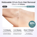 IPL Laser Hair Removal for Women & Men with Cooling Technology | 5 Modes LCD Screen for Painless Face & Body Treatments - Infinity Warehouse