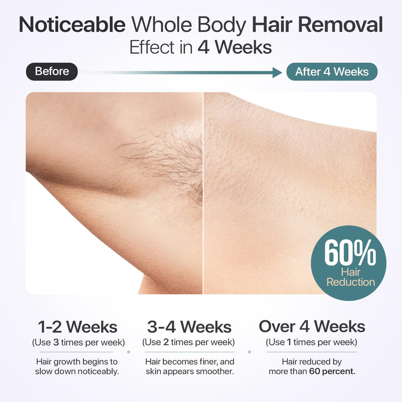 IPL Laser Hair Removal for Women & Men with Cooling Technology | 5 Modes LCD Screen for Painless Face & Body Treatments - Infinity Warehouse