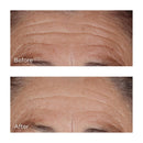 Perricone MD High Potency Hyaluronic Intensive Hydrating Serum, 2 fl. oz. Infinity Warehouse