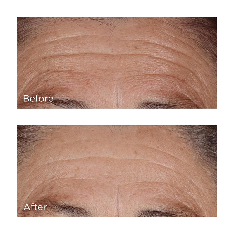 Perricone MD High Potency Hyaluronic Intensive Hydrating Serum, 2 fl. oz. Infinity Warehouse