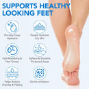 Uruses Urea Cream 60% plus Salicylic Acid 2% Urea Foot Care Stick, Foot Cream for Foot Callus Remover, Feet Moisturizer Stick for Dry Cracked Heels, Hands, Knees, Hydrating Heel Balm, Easy To Use Infinity Warehouse