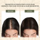 Batana Oil for Hair Growth, 100% Pure & Natural Raw Batana Oil, Dr. Sebi Organic Oil from Honduras, Care for Hair Thickness & Scalp & Skin, 4.23 fl oz, 1 Bottle with 2 Caps Infinity Warehouse