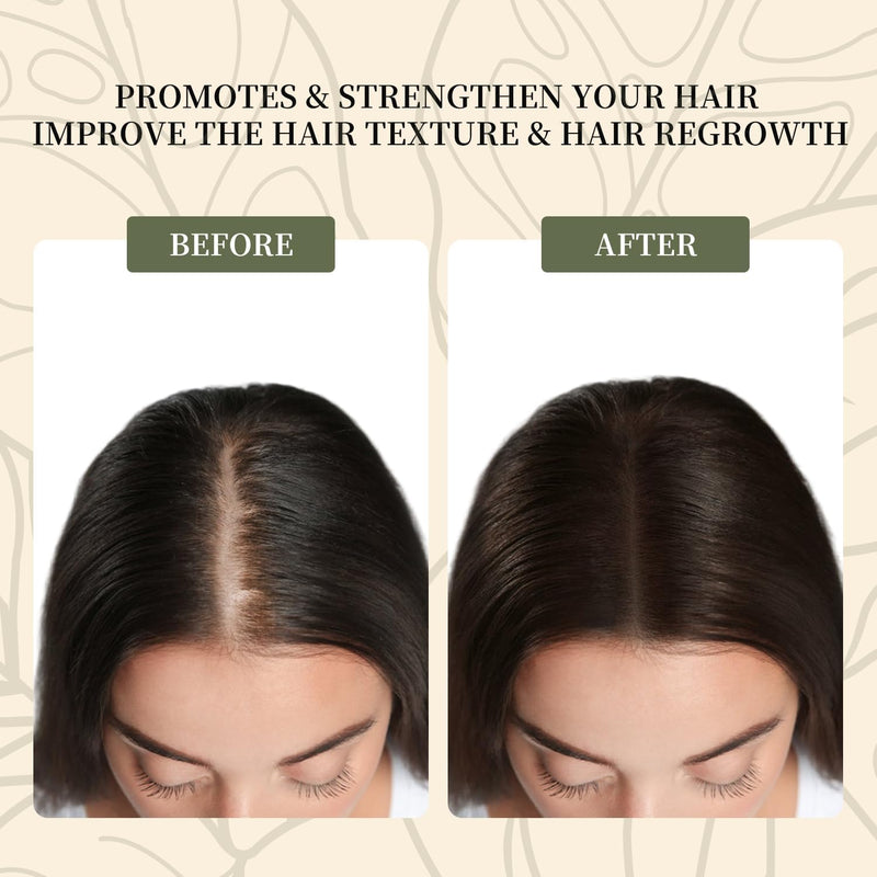 Batana Oil for Hair Growth, 100% Pure & Natural Raw Batana Oil, Dr. Sebi Organic Oil from Honduras, Care for Hair Thickness & Scalp & Skin, 4.23 fl oz, 1 Bottle with 2 Caps Infinity Warehouse
